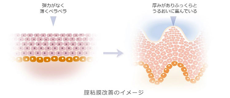 膣粘膜上皮の変化
